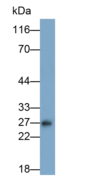 Polyclonal Antibody to C Reactive Protein (CRP)