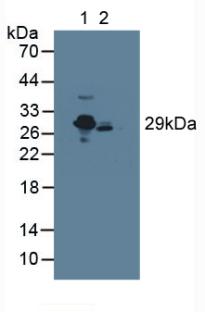 Polyclonal Antibody to C Reactive Protein (CRP)