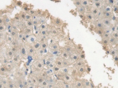 Polyclonal Antibody to C Reactive Protein (CRP)