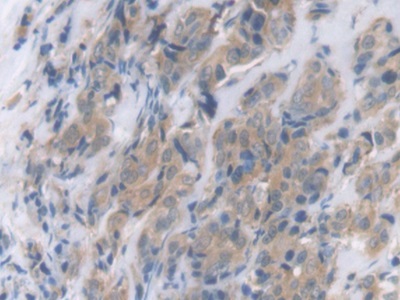 Polyclonal Antibody to C Reactive Protein (CRP)