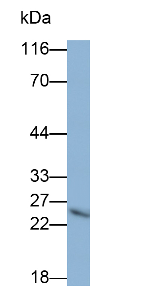 Polyclonal Antibody to C Reactive Protein (CRP)