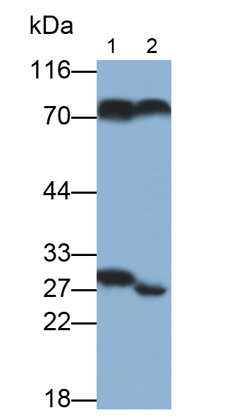 Polyclonal Antibody to C Reactive Protein (CRP)