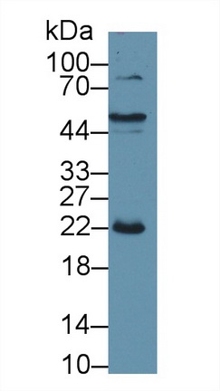 Polyclonal Antibody to C Reactive Protein (CRP)