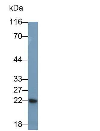 Polyclonal Antibody to C Reactive Protein (CRP)