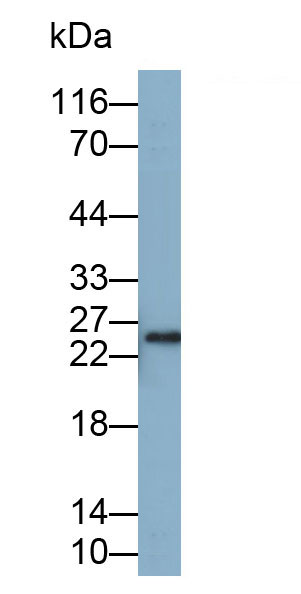 Polyclonal Antibody to C Reactive Protein (CRP)