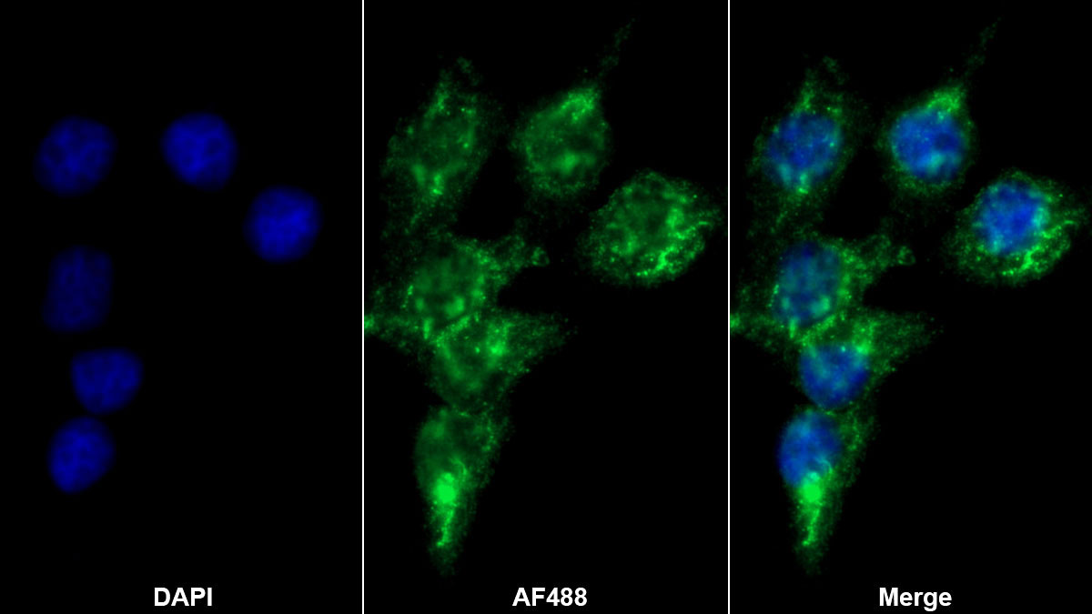 Polyclonal Antibody to C Reactive Protein (CRP)