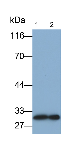 Polyclonal Antibody to C Reactive Protein (CRP)