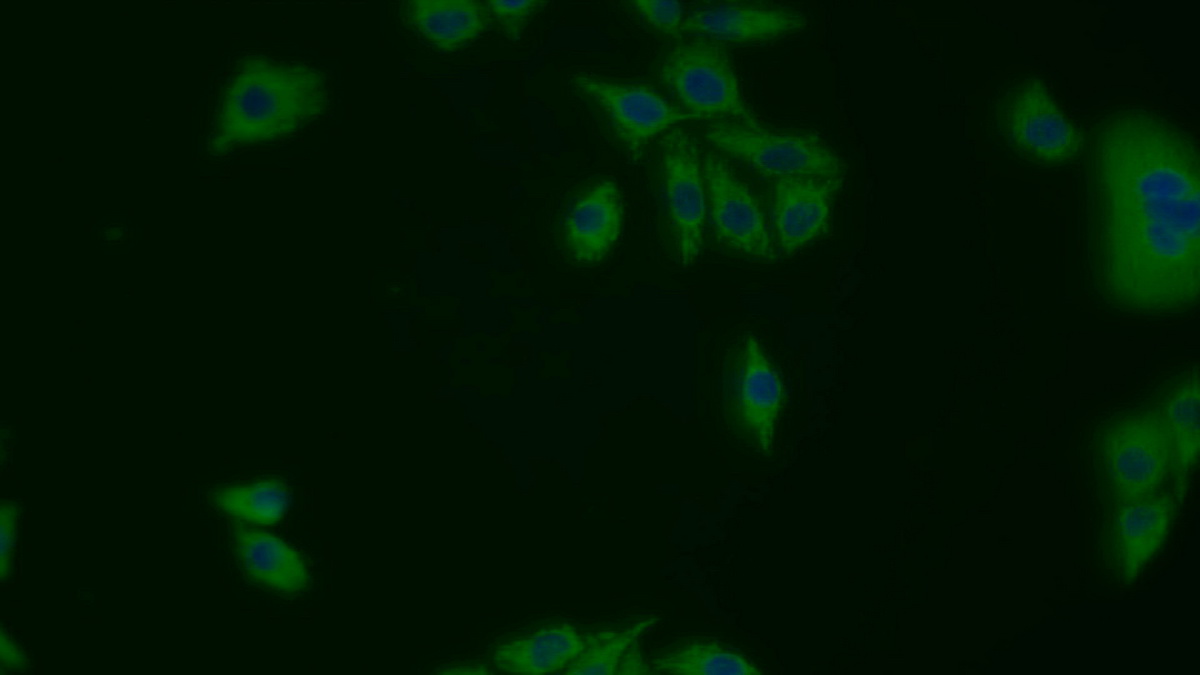 Polyclonal Antibody to Heat Shock Protein 60 (Hsp60)