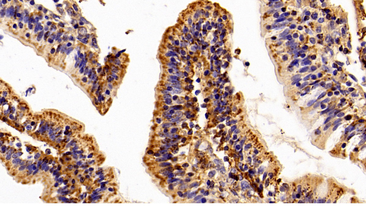 Polyclonal Antibody to Heat Shock Protein 60 (Hsp60)