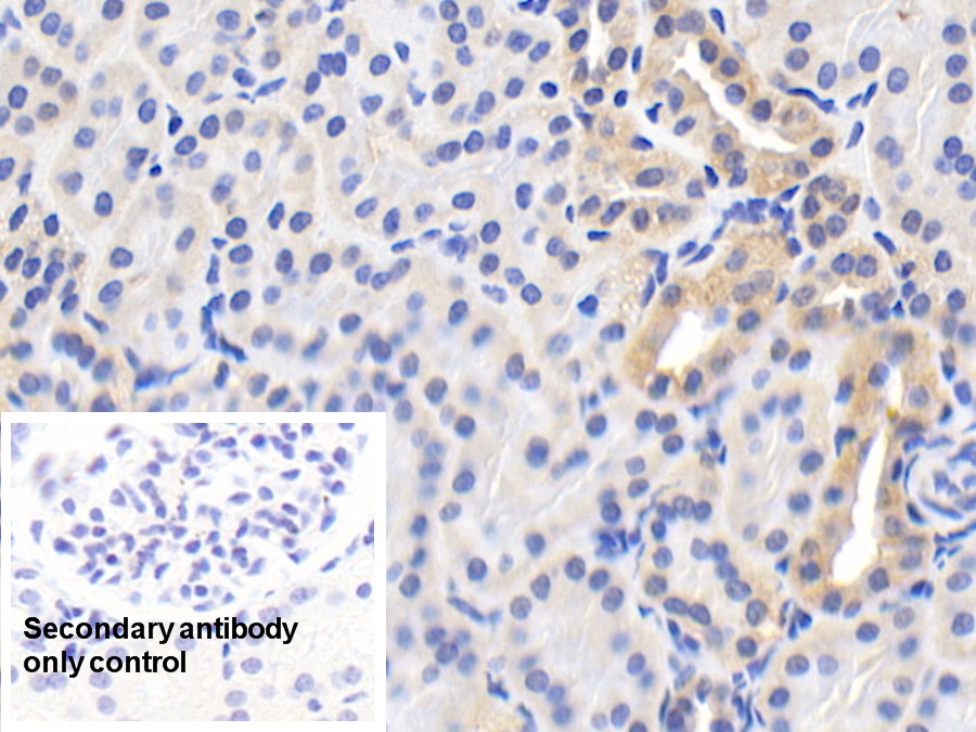 Polyclonal Antibody to Heat Shock Protein 60 (Hsp60)