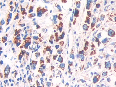 Polyclonal Antibody to Heat Shock Protein 60 (Hsp60)