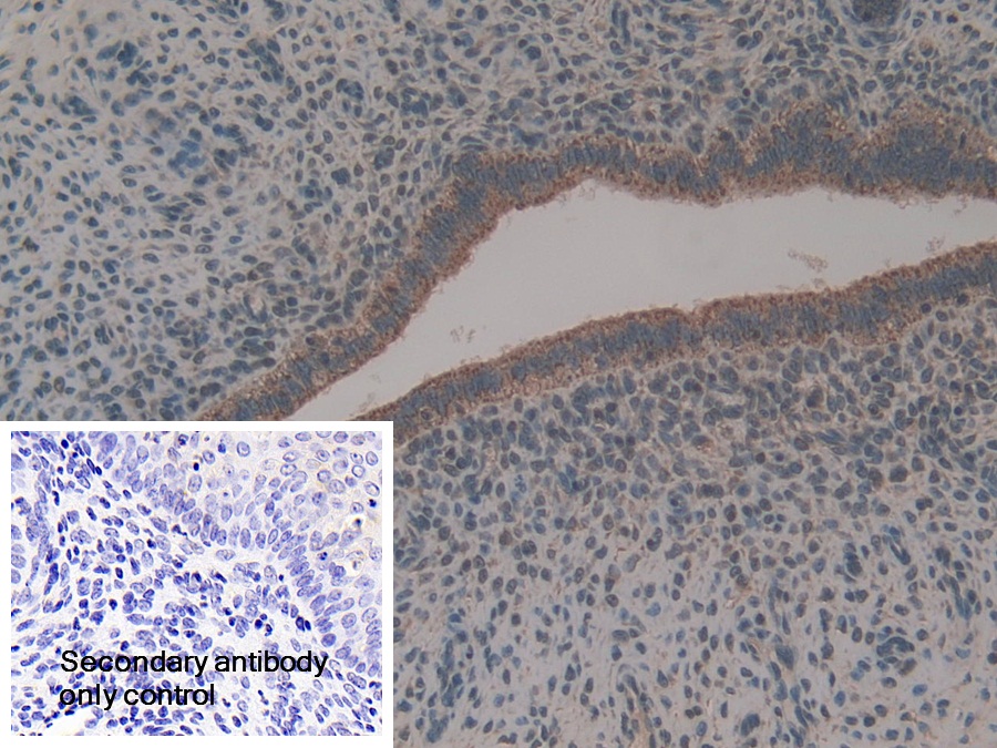 Polyclonal Antibody to Heat Shock Protein 60 (Hsp60)