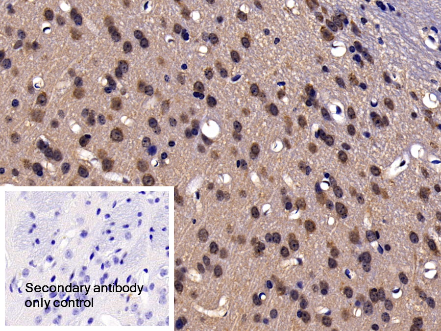 Polyclonal Antibody to Heat Shock Protein 90kDa Beta 1 (HSP90b1)