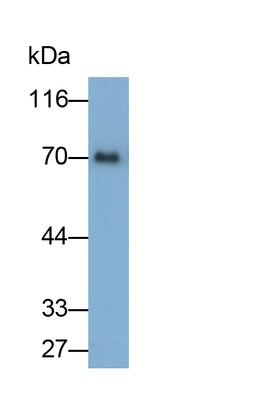 Polyclonal Antibody to Ischemia Modified Albumin (IMA)