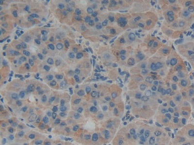 Polyclonal Antibody to Tumor Necrosis Factor Ligand Superfamily, Member 14 (TNFSF14)