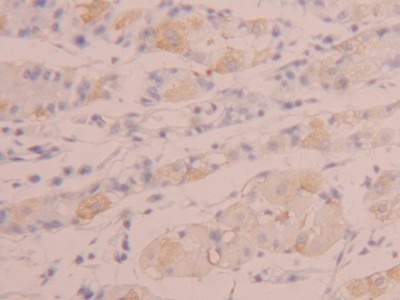 Polyclonal Antibody to Tumor Necrosis Factor Ligand Superfamily, Member 14 (TNFSF14)