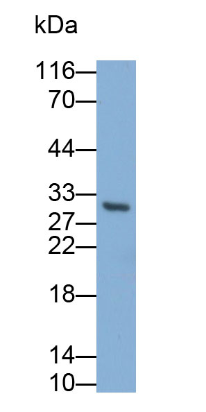 Polyclonal Antibody to Tumor Necrosis Factor Ligand Superfamily, Member 14 (TNFSF14)