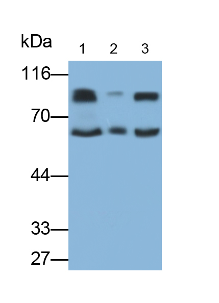 Polyclonal Antibody to Thrombin/Antithrombin Complex (TAT)