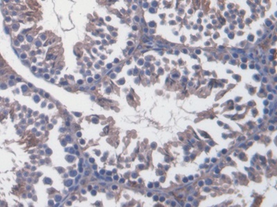 Polyclonal Antibody to Von Willebrand Factor (vWF)