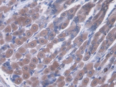 Polyclonal Antibody to Von Willebrand Factor (vWF)