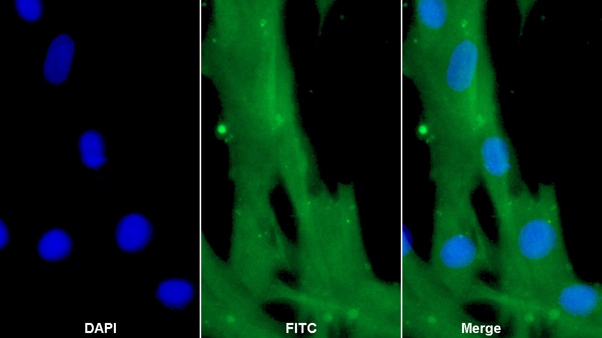 Polyclonal Antibody to Von Willebrand Factor (vWF)