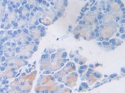 Polyclonal Antibody to Von Willebrand Factor (vWF)