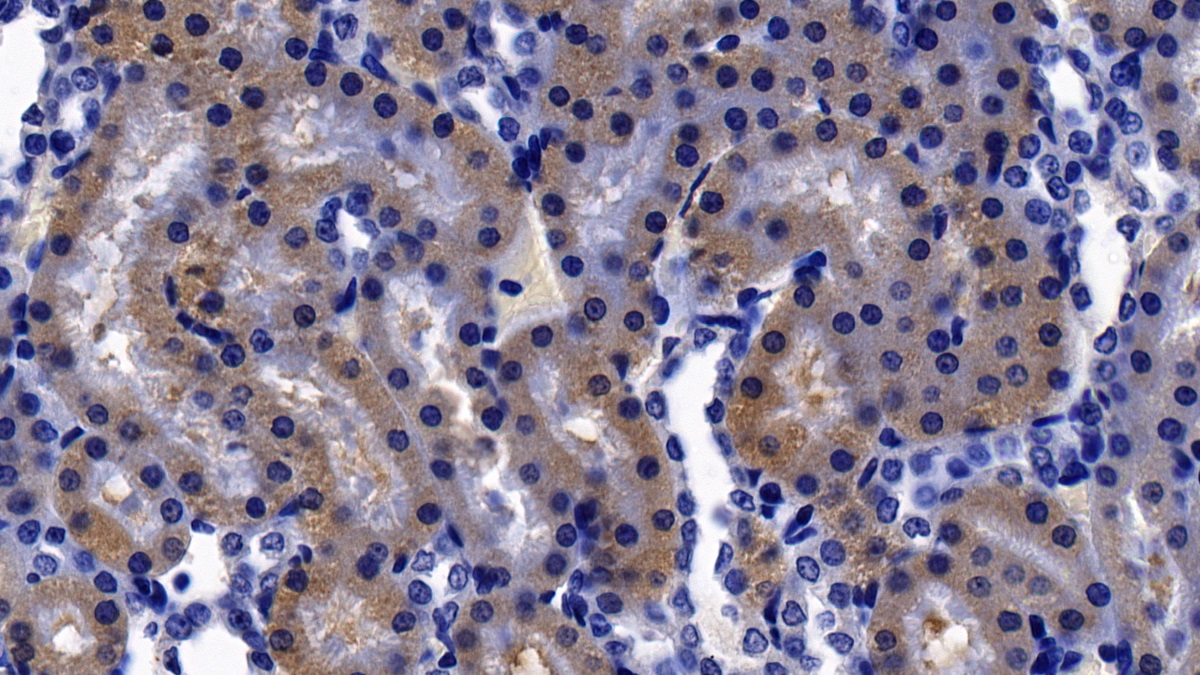 Polyclonal Antibody to Corticotropin Releasing Factor (CRF)