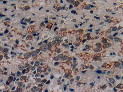 Polyclonal Antibody to Corticotropin Releasing Factor (CRF)