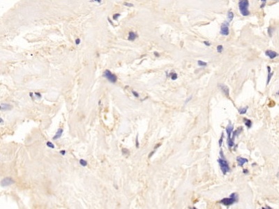 Polyclonal Antibody to Adrenocorticotropic Hormone (ACTH)