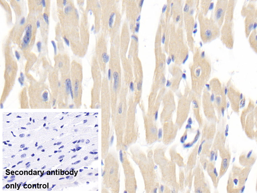 Polyclonal Antibody to Nitric Oxide Synthase 2, Inducible (NOS2)