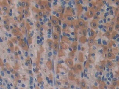 Polyclonal Antibody to Nitric Oxide Synthase 2, Inducible (NOS2)