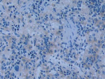 Polyclonal Antibody to Nitric Oxide Synthase 2, Inducible (NOS2)