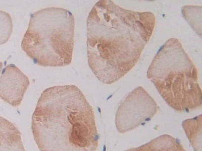 Polyclonal Antibody to Nitric Oxide Synthase 2, Inducible (NOS2)