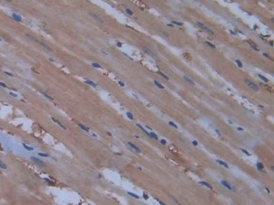 Polyclonal Antibody to Nitric Oxide Synthase 2, Inducible (NOS2)