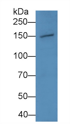 Polyclonal Antibody to Nitric Oxide Synthase 2, Inducible (NOS2)