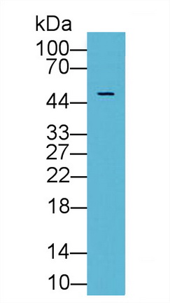 Polyclonal Antibody to Inhibin Beta A (INHbA)