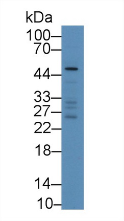 Polyclonal Antibody to Von Willebrand Factor A Domain Containing Protein 1 (vWA1)