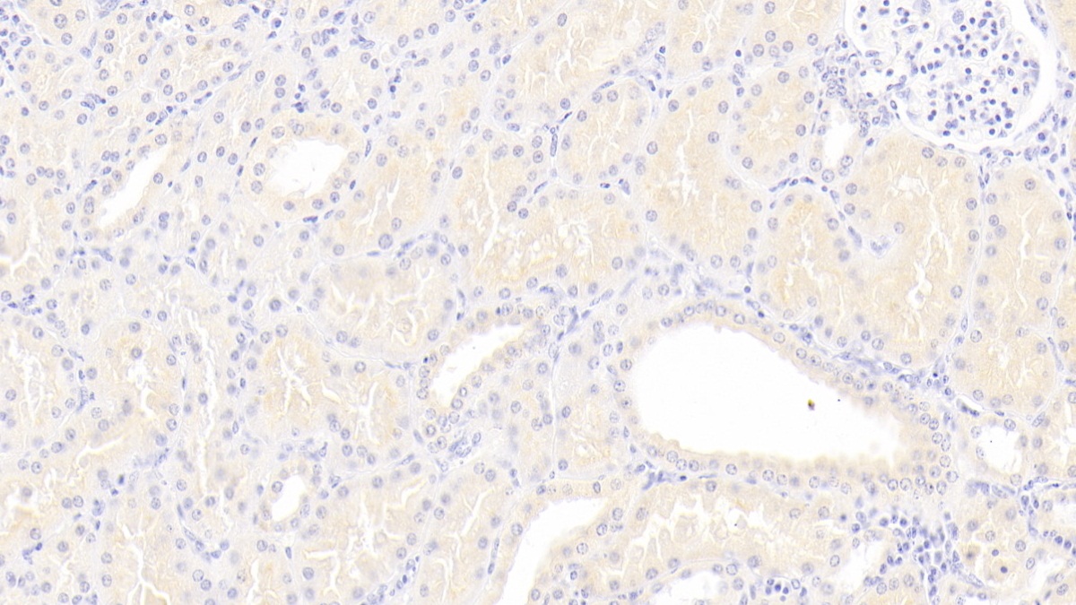 Polyclonal Antibody to Lipoprotein, a (Lpa)