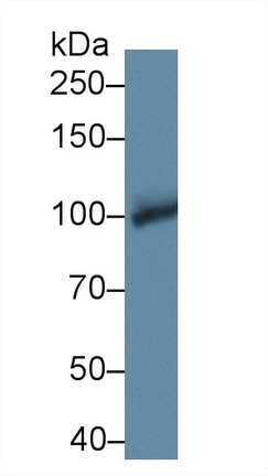 Polyclonal Antibody to Glycogen Phosphorylase, Brain (PYGB)