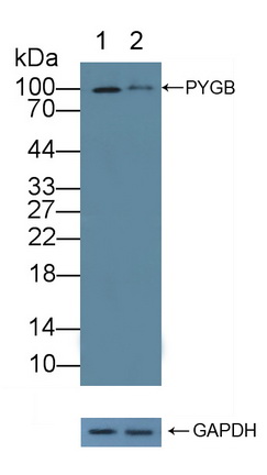 Polyclonal Antibody to Glycogen Phosphorylase, Brain (PYGB)