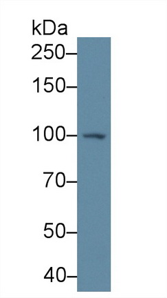 Polyclonal Antibody to Glycogen Phosphorylase, Brain (PYGB)