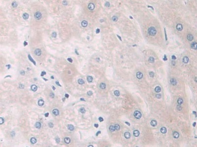 Polyclonal Antibody to Glycogen Phosphorylase, Brain (PYGB)