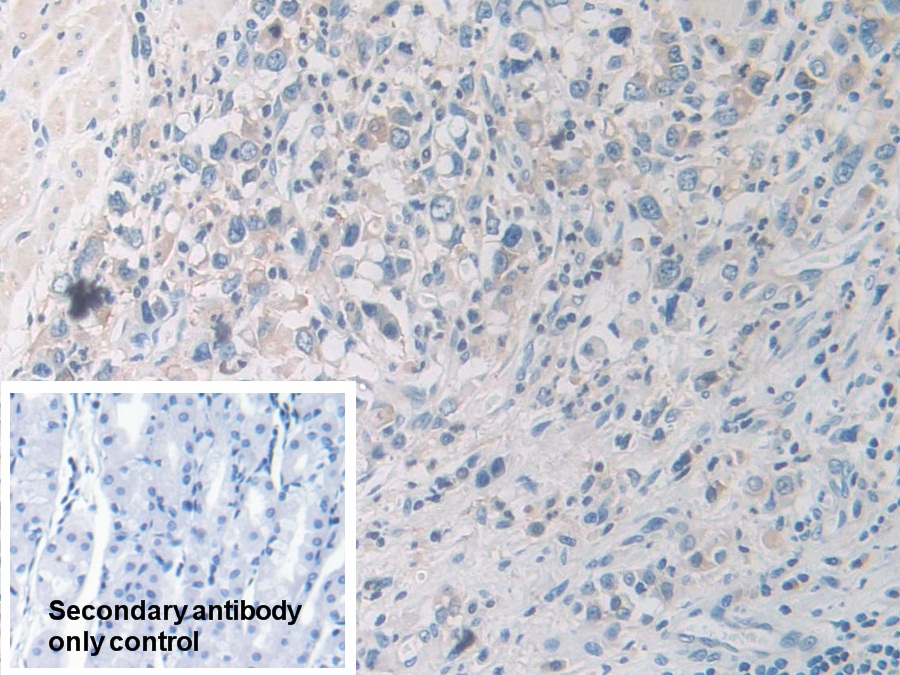 Polyclonal Antibody to Glycogen Phosphorylase, Brain (PYGB)