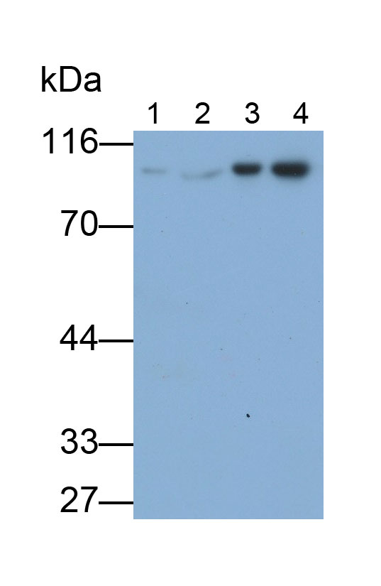 Polyclonal Antibody to Glycogen Phosphorylase, Brain (PYGB)