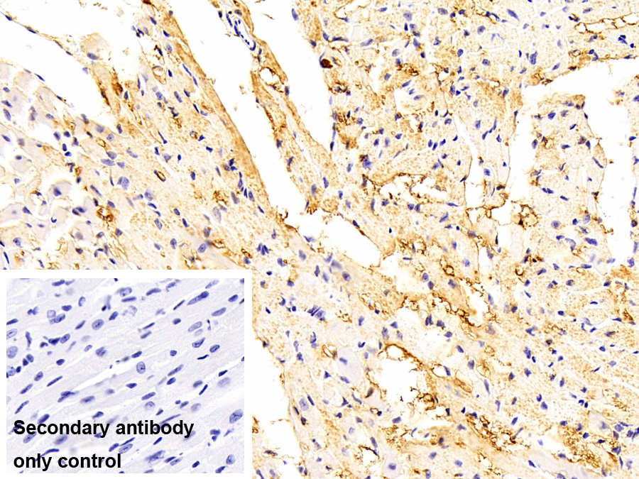 Polyclonal Antibody to Glycogen Phosphorylase, Brain (PYGB)