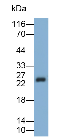 Polyclonal Antibody to Prolactin (PRL)