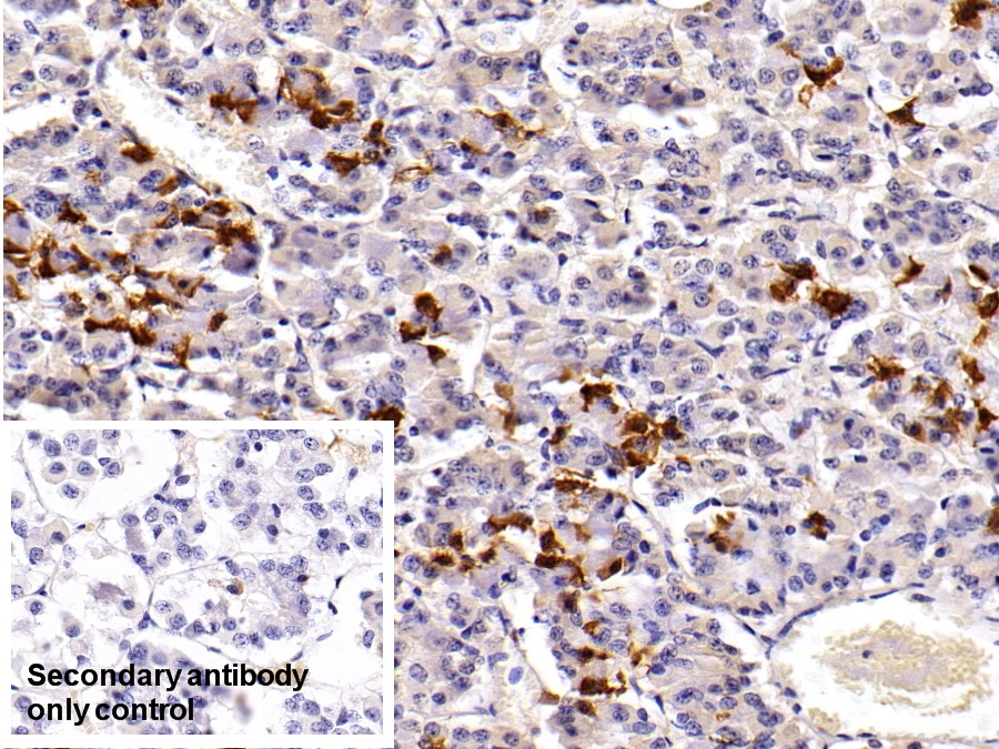 Polyclonal Antibody to Prolactin (PRL)