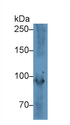 Polyclonal Antibody to Glycogen Phosphorylase, Muscle (PYGM)