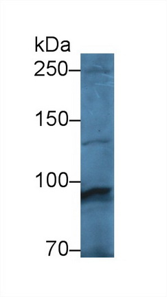 Polyclonal Antibody to Glycogen Phosphorylase, Muscle (PYGM)