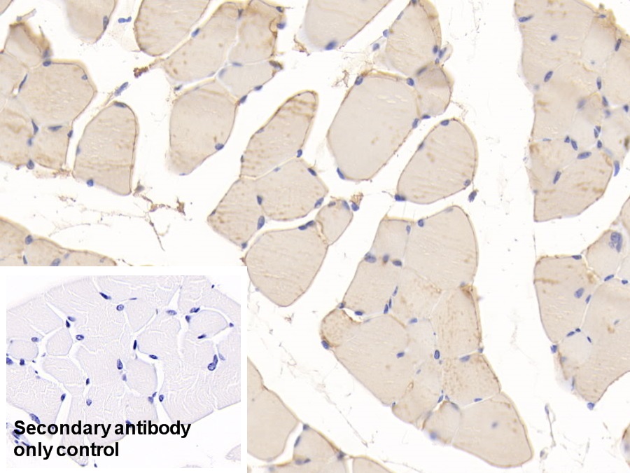 Polyclonal Antibody to Glycogen Phosphorylase, Muscle (PYGM)